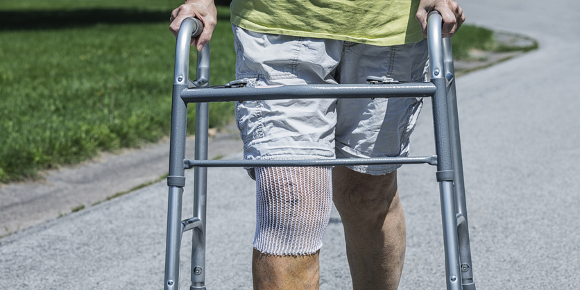 Joint Replacement Advised for Some Arthritis Patients